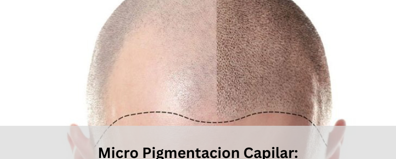 micro pigmentacion capilar
