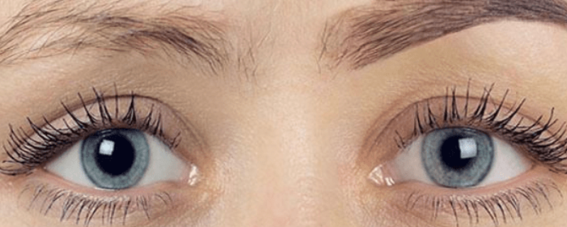 hair transplant eyebrows