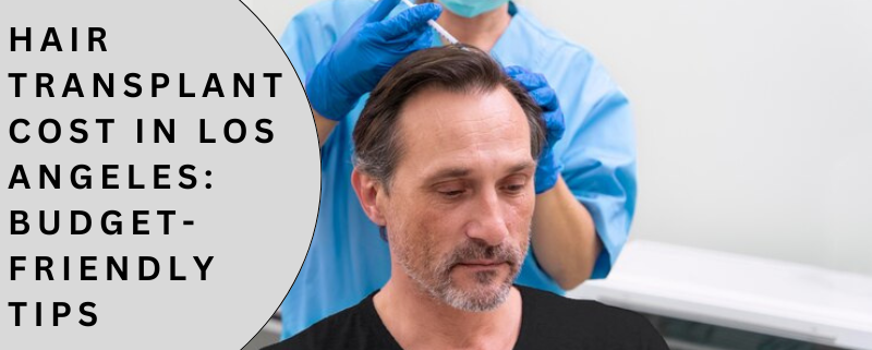 hair transplant cost Los Angeles
