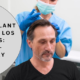 hair transplant cost Los Angeles