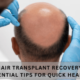 Hair Transplant Recovery