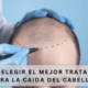 Tratamiento Para La Caida Del Cabello